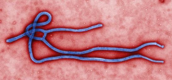 Six Considerations For Employers Faced With The Ebola Virus Or Other Infectious 