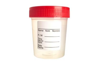 drug test, specimen jar