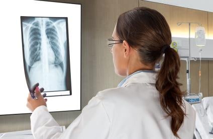 doctor checking xrays for oncology care procedures