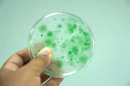 E. Coli outbreak investigation: Petri Dish with Bacteria