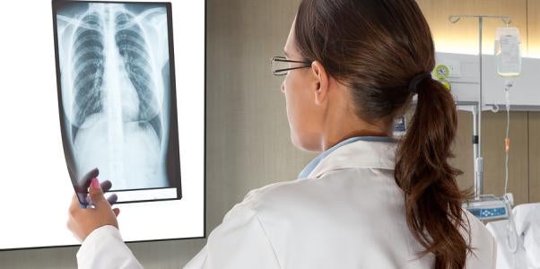 female doctor reviewing an xray of a lung