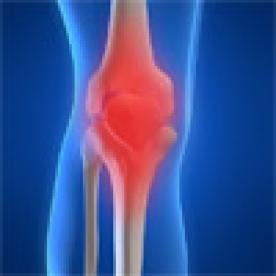 Health, Comprehensive Joint Replacement Bundled Payment Program, joint, knee