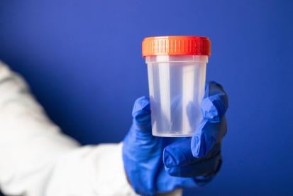 Job Applicant Drug Testing Not Eligible for Employer Compensation