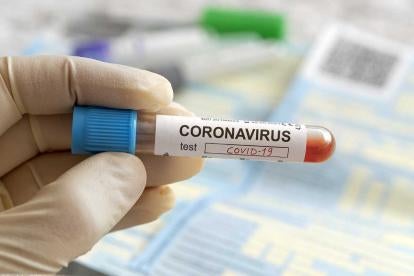 coronavirus covid-19 testing