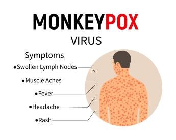 California Addresses Monkeypox Prevention in the Workplace