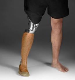 Leg Prosthesis